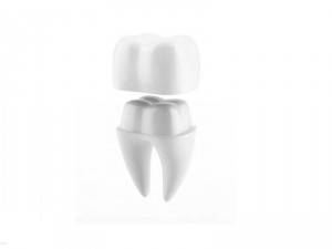 How to care for a dental crown or "sheath"? 0