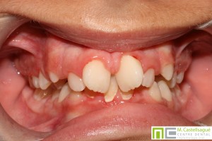 Ortodoncia avanzada: preguntas frecuentes 0