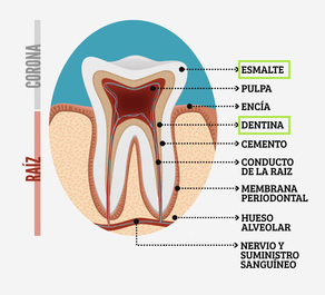 parts-dent-dentista-granollers-castellsagué-esmalte-i-dentina