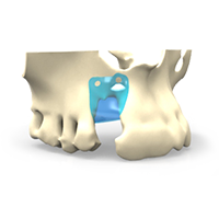 barrera oclusiva dental