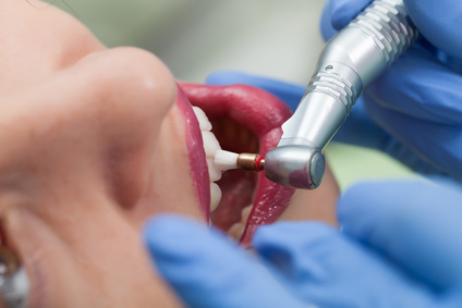 Manteniment d’implants dentals: recomanacions 1