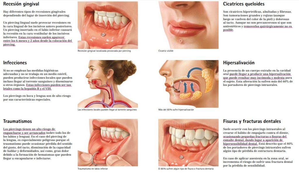 Pírcing oral: un perill per a la salut bucodental 0